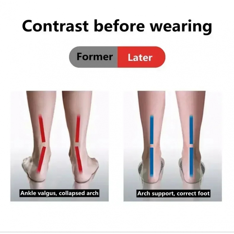 2 Pcs EVA Flat Feet Arch Suppo - Women'S Shoes For Flat Feet ulasan dan harga